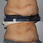 Goal: reduce belly fat