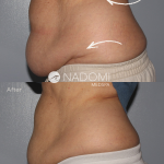 Goal: permanently eliminate belly fat, more defined abdominals