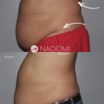Goal: permanently remove belly fat, more defined abdominals
