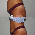 Goal: permanently remove belly fat, more defined abdominals